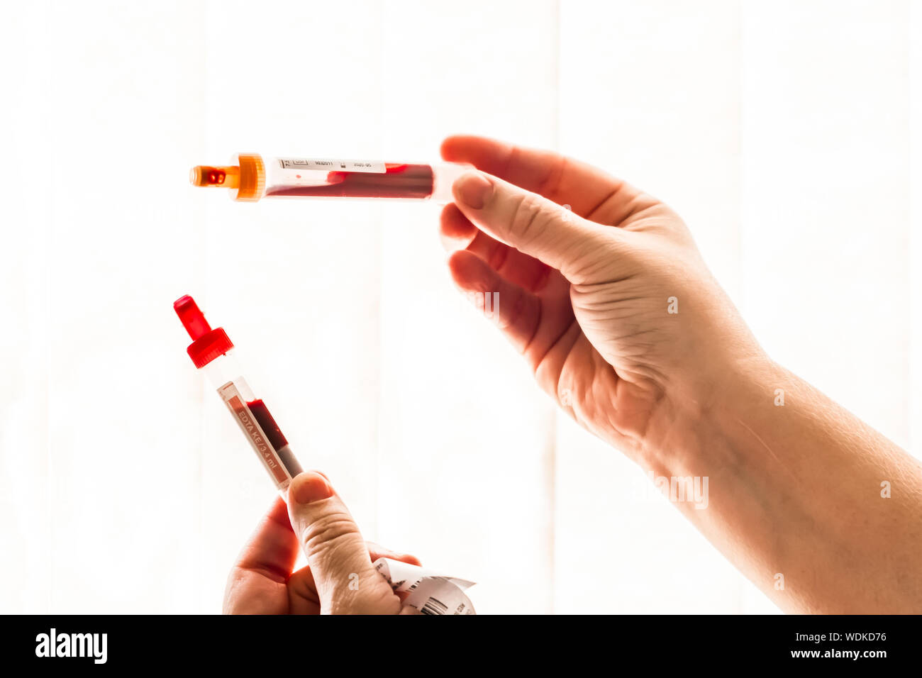 Phials, vials, or tubes of blood samples being held up against a window. Stock Photo