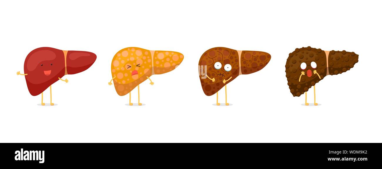 Stages human liver character damage concept set. Healthy liver