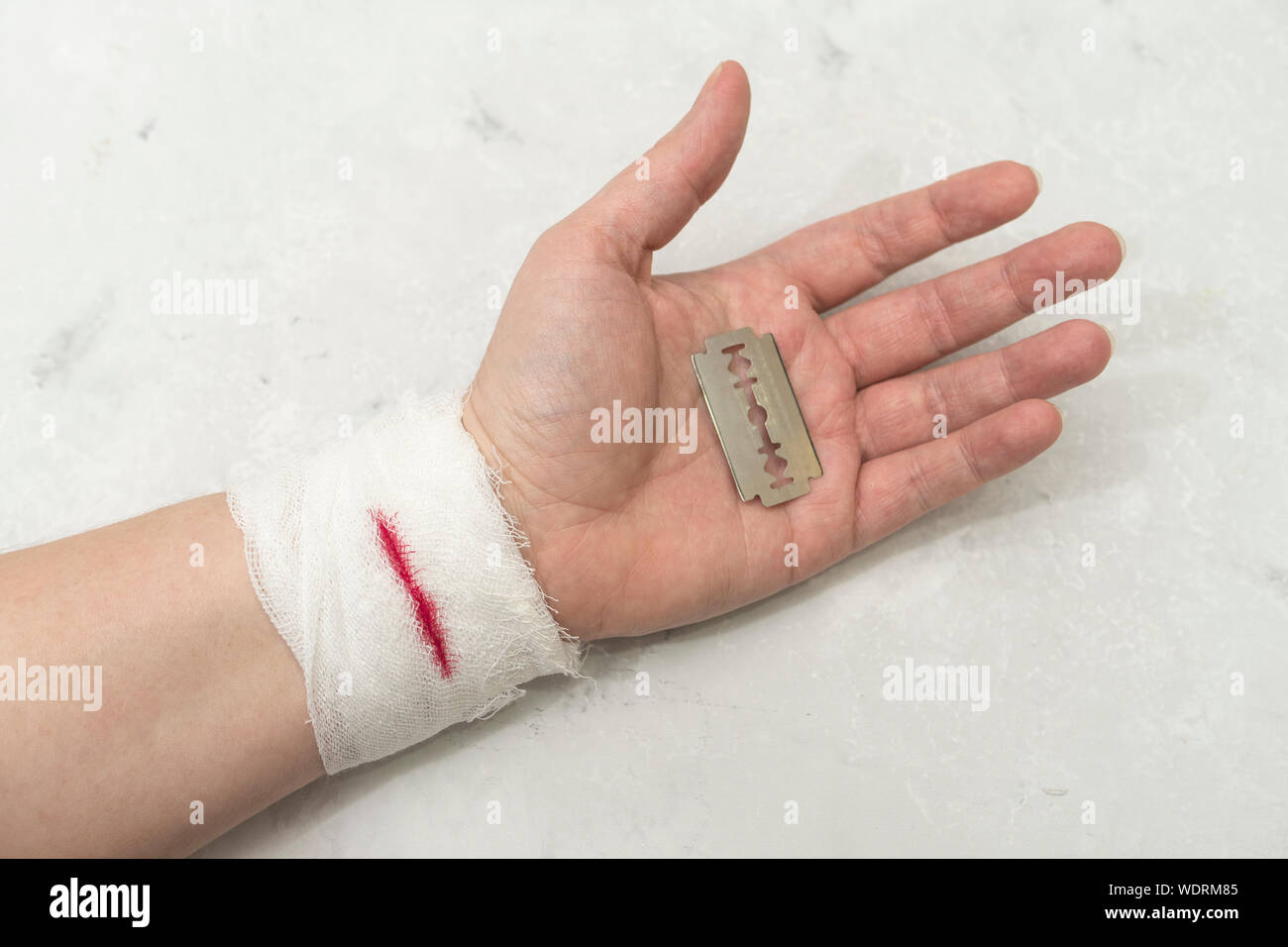 Hand injury hi-res stock photography and images - Alamy
