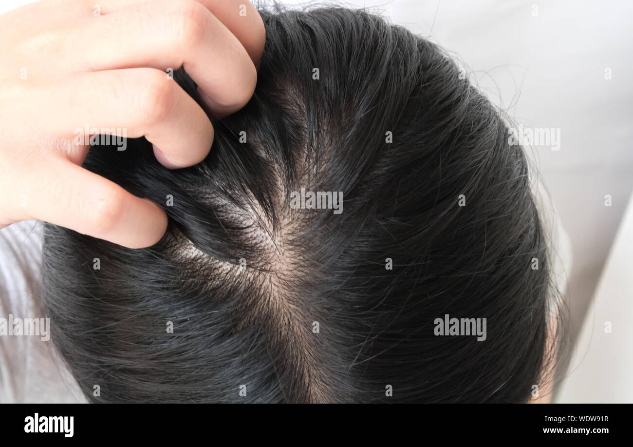 Cropped Image Of Woman Scratching Head Stock Photo