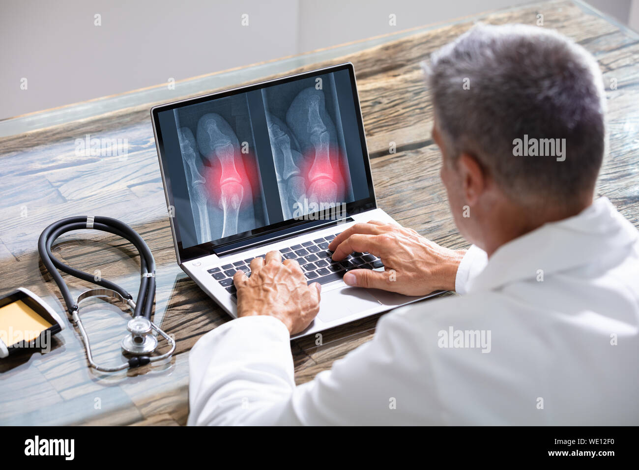 Doctor Looking At Foot X-ray On Laptop With Stethoscope Stock Photo
