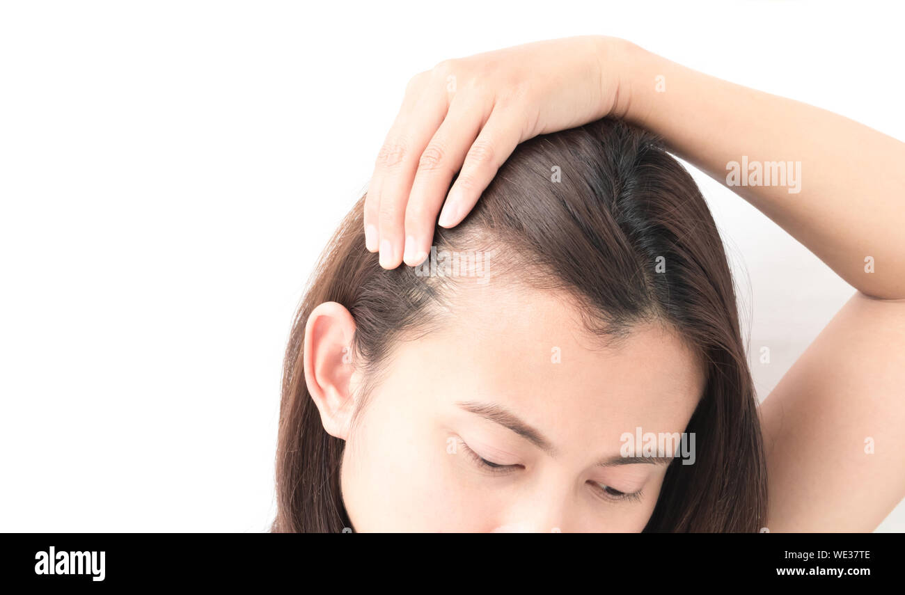 Woman receding hairline hi-res stock photography and images - Alamy Woman receding hairline hi-res stock photography and images - Alamy