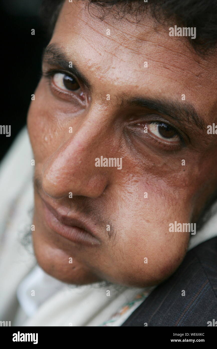 KHAT IN YEMEN Stock Photo