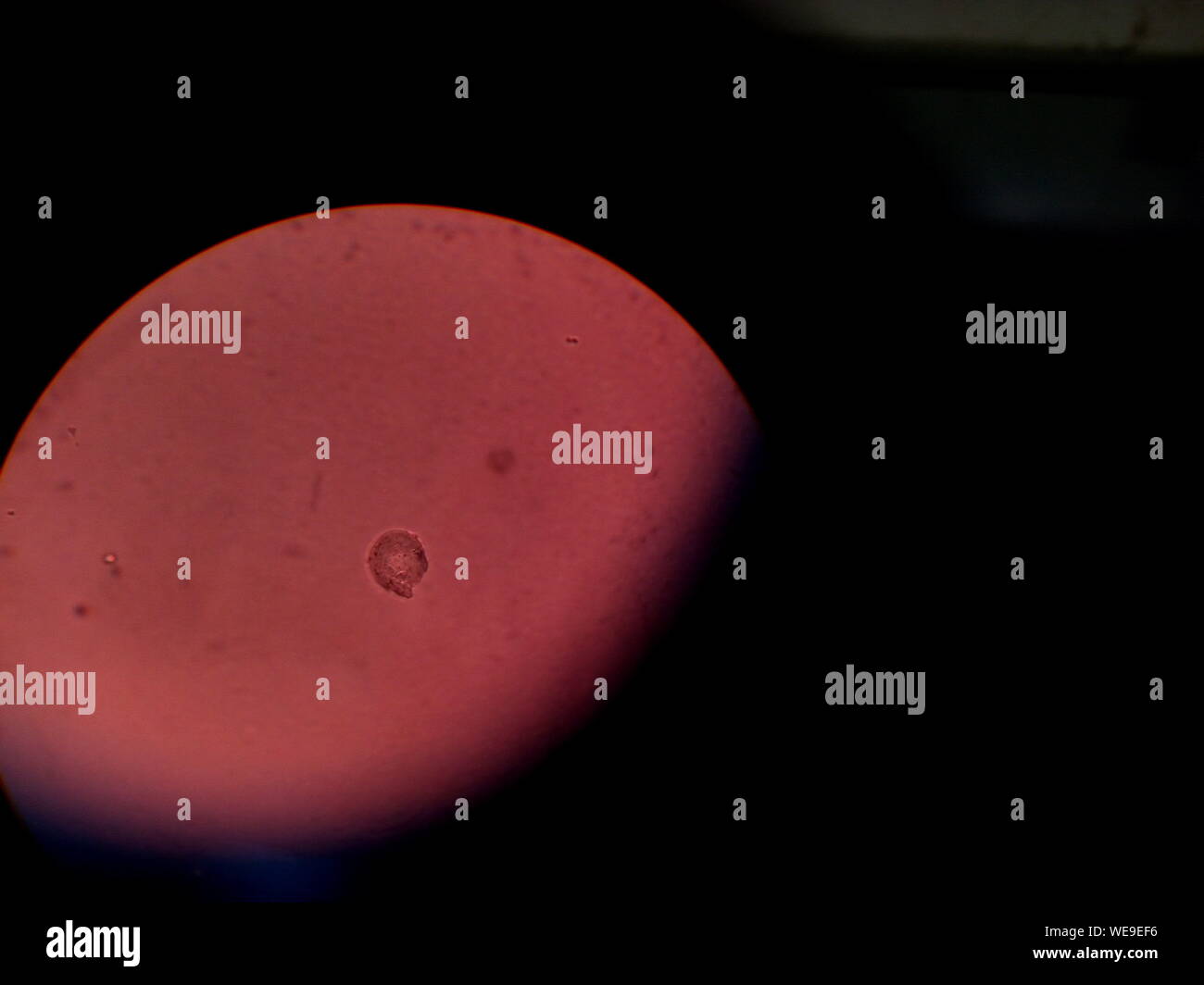 Microscope blood cells hires stock photography and images Alamy