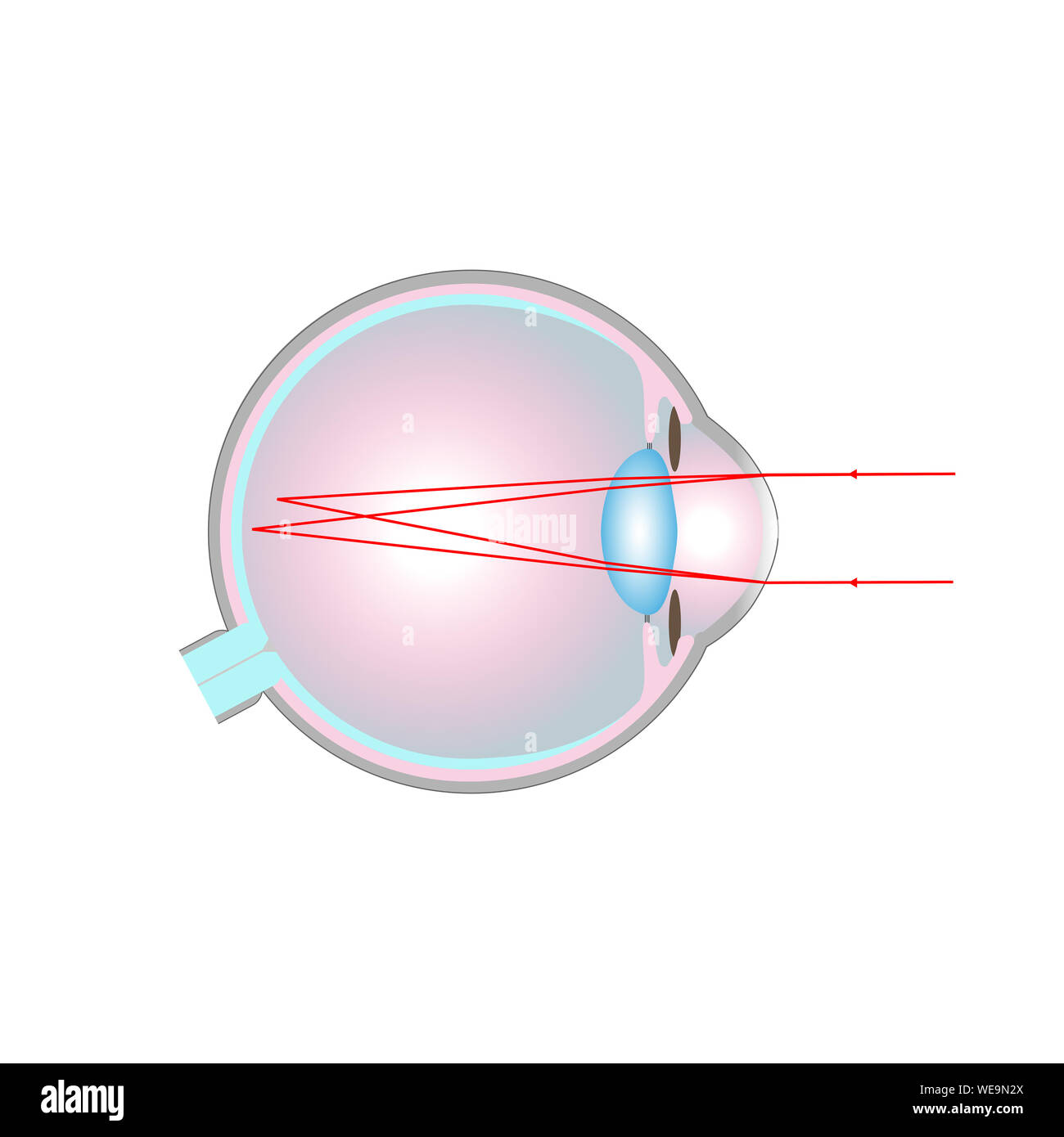 Astigmatic eye hi-res stock photography and images - Alamy