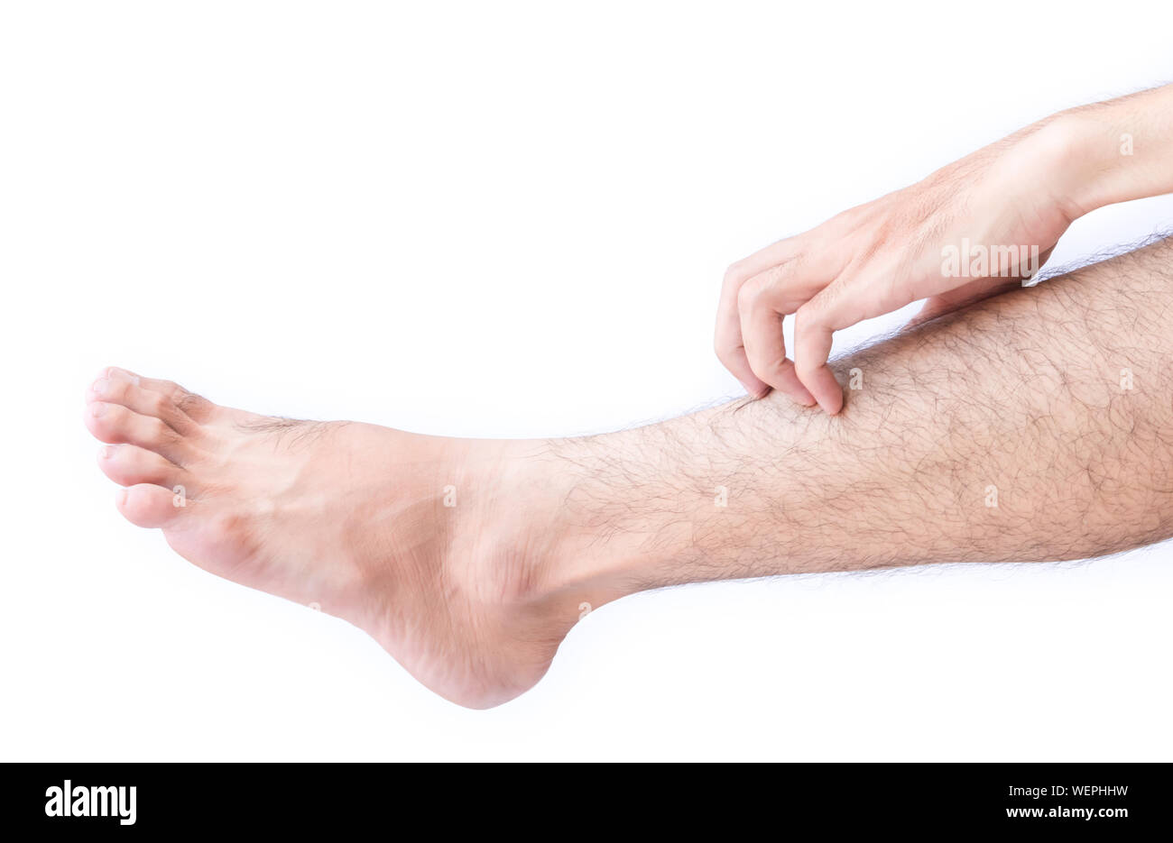 Cropped Image Of Man Scratching Leg Against White Background Stock Photo Alamy