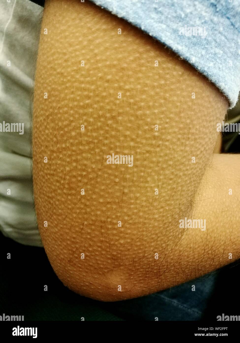 Goosebumps arm hires stock photography and images Alamy