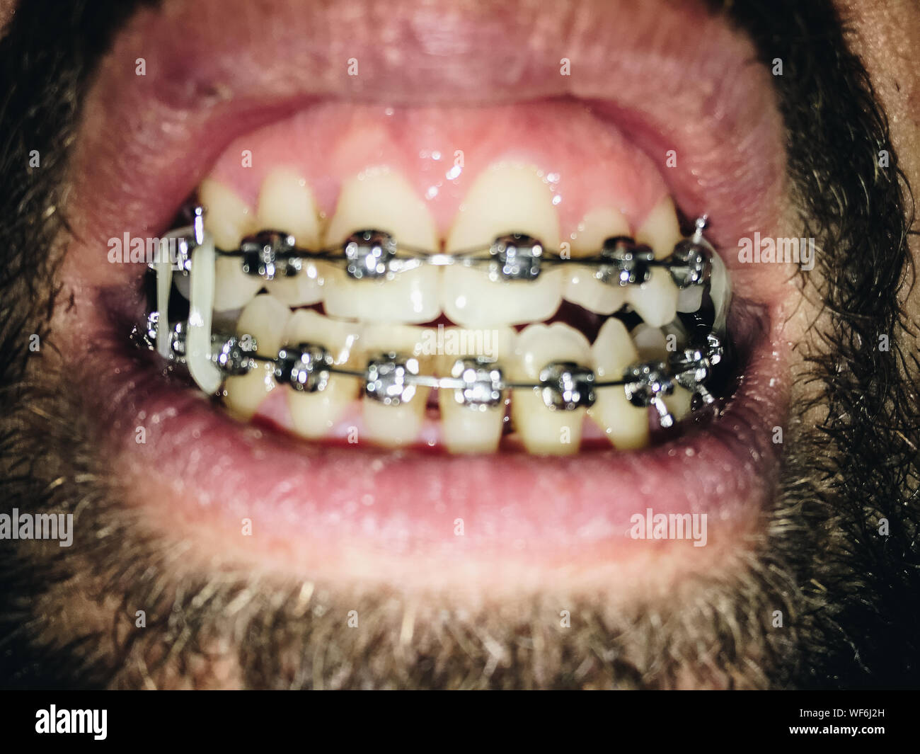 Man braces close up hires stock photography and images Alamy