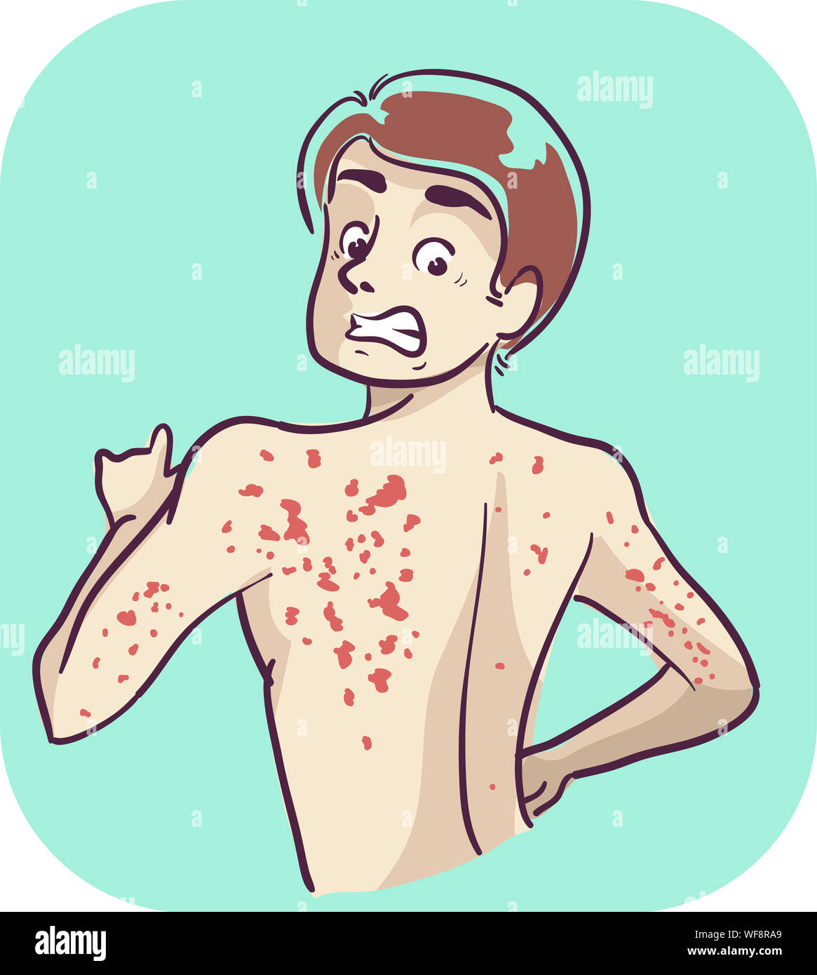 Illustration of a Teenage Boy Looking at His Back and Finding Red ...