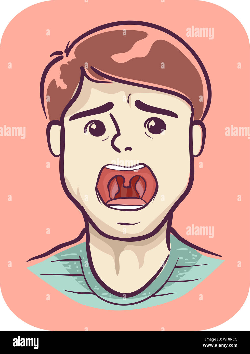 Illustration of a Teenage Boy with Open Mouth and Showing Sore Throat Stock Photo