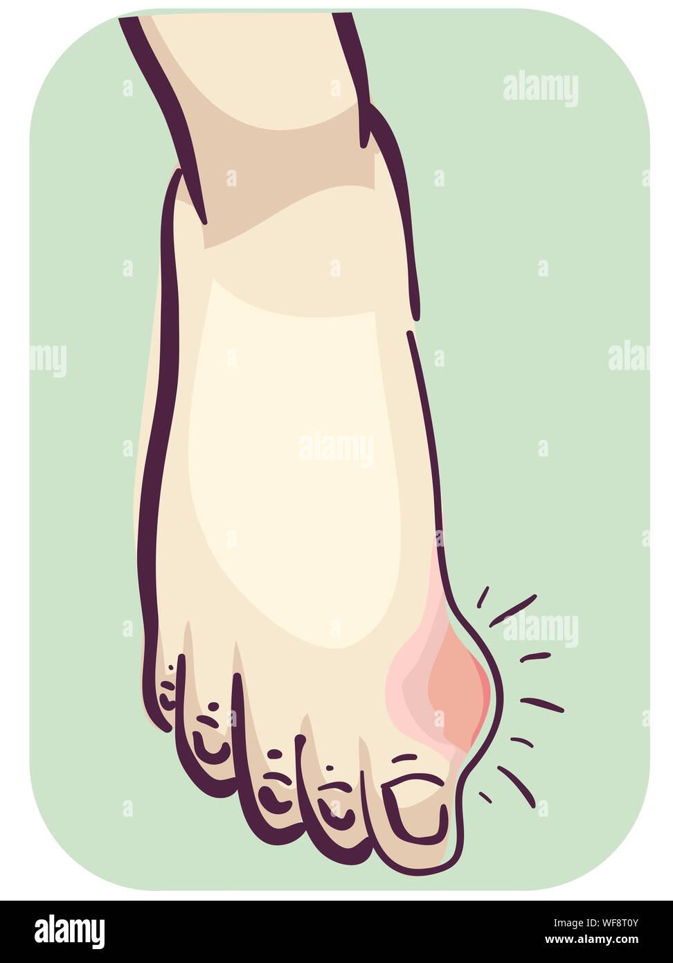 Gout cartoon Cut Out Stock Images & Pictures Alamy