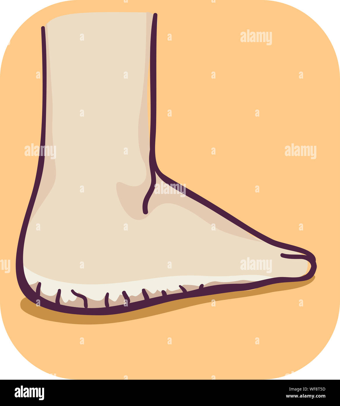Illustration of a Dry and Thick Skin of the Feet Stock Photo