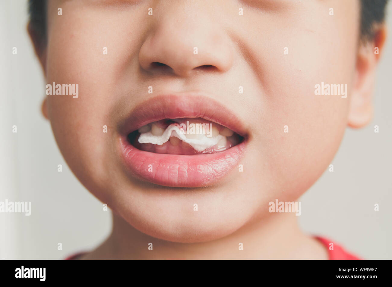 Close-up Of Young Boy With Missing Tooth Stock Photo