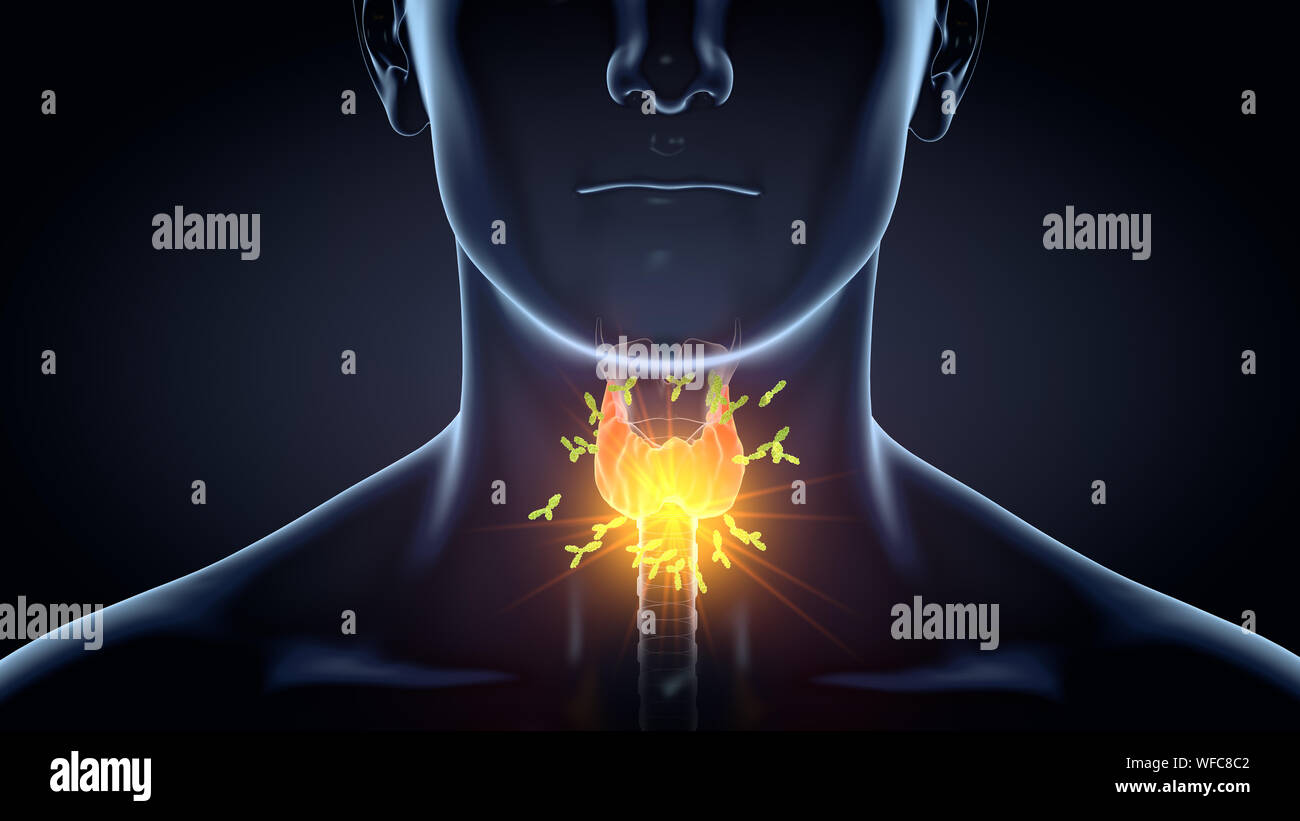 Medically 3D illustration showing antibodies attacking thyroid gland of
