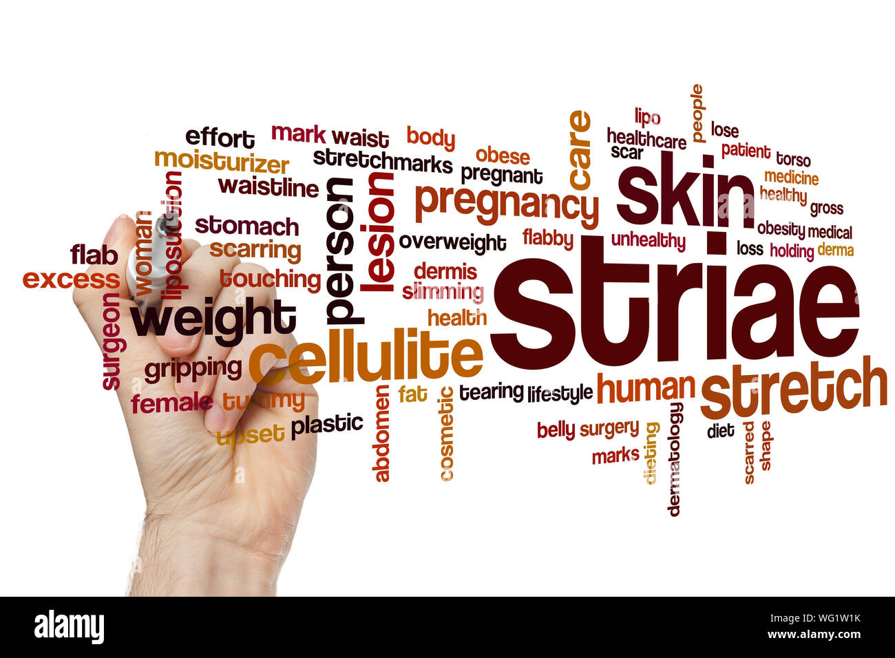 Striae word cloud concept Stock Photo