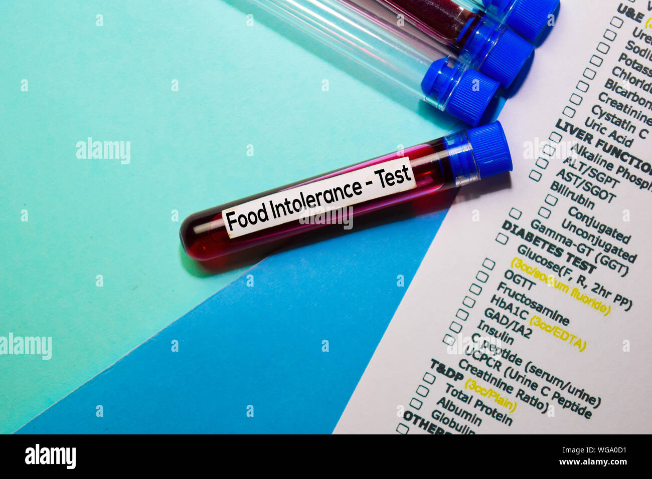 Food Intolerance - Test with blood sample. Top view isolated on office ...