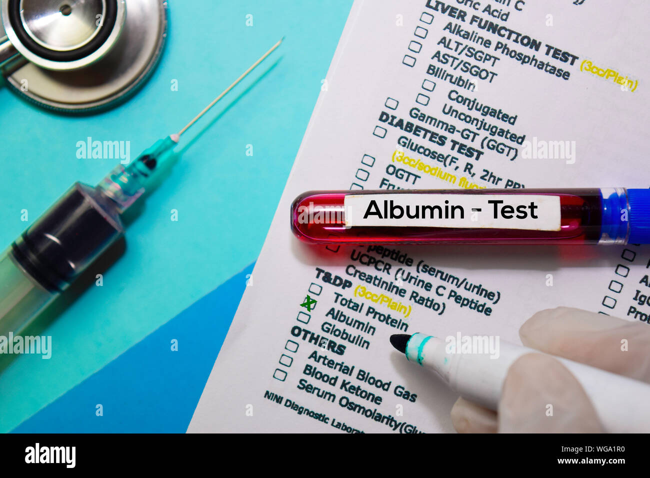 Albumin molecule hires stock photography and images Alamy