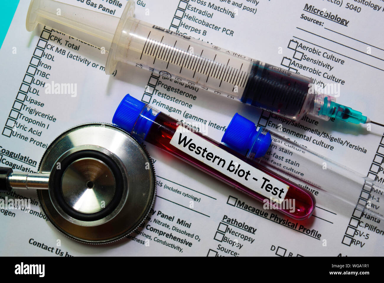 Western blot - Test with blood sample. Top view isolated on office desk.  Healthcare/Medical concept Stock Photo - Alamy
