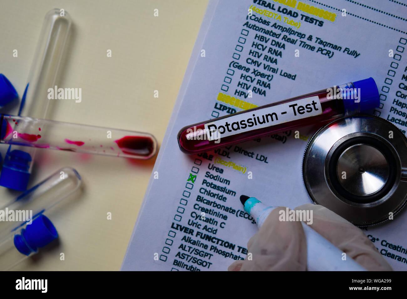 Potassium - Test with blood sample. Top view isolated on office desk.  Healthcare/Medical concept Stock Photo - Alamy
