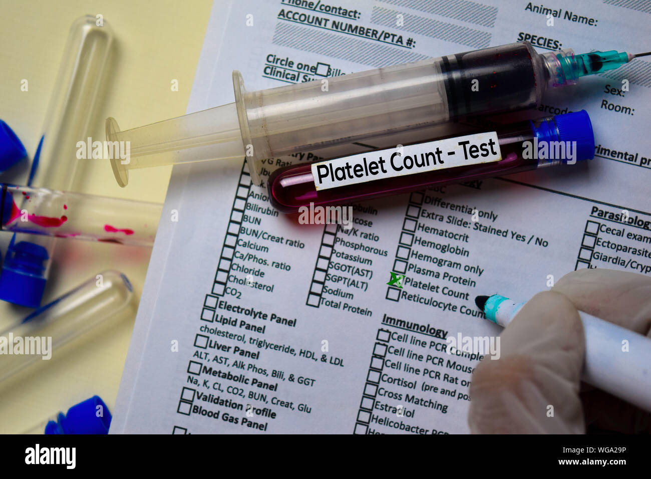 Platelet Count Test with blood sample. Top view isolated on office