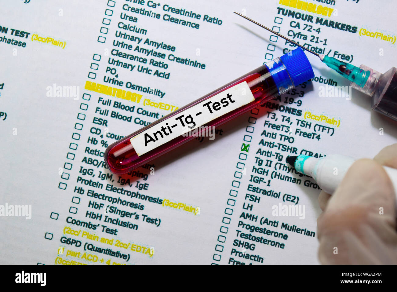 Thyroglobulin hires stock photography and images Alamy