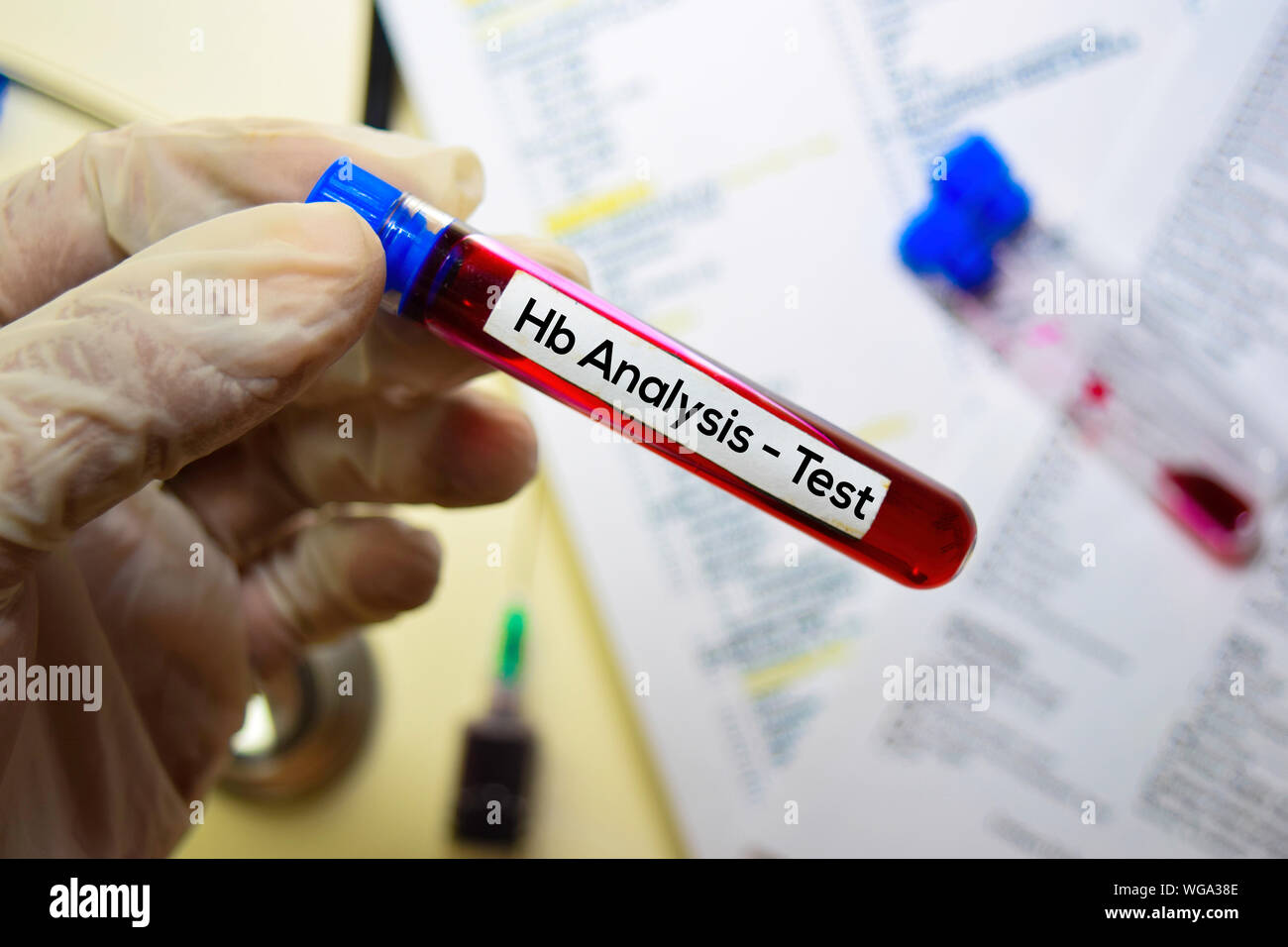 Hb Analysis Test with blood sample. Top view isolated on office desk