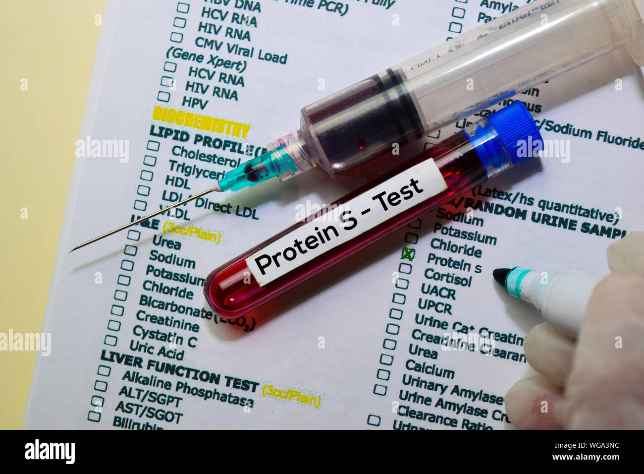 Protein S Test with blood sample. Top view isolated on office desk