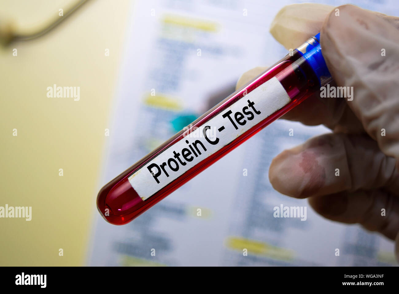 Protein C Test with blood sample. Top view isolated on office desk