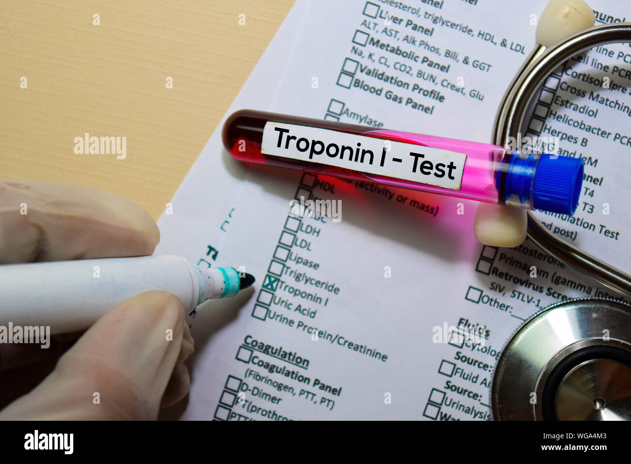 Troponin I Test with blood sample. Top view isolated on office desk