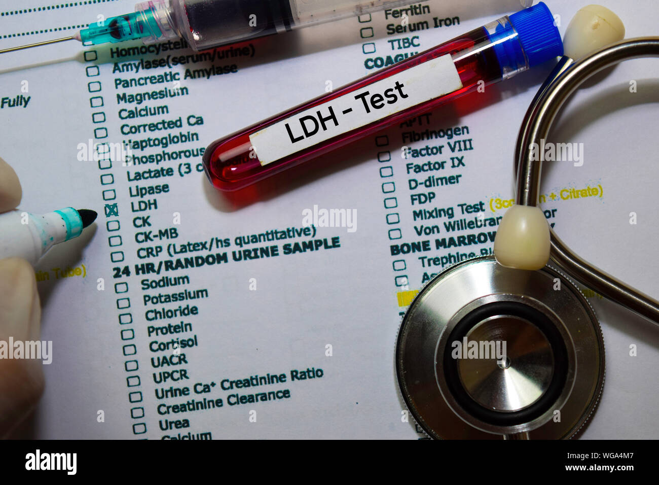 LDH Test with blood sample. Top view isolated on office desk