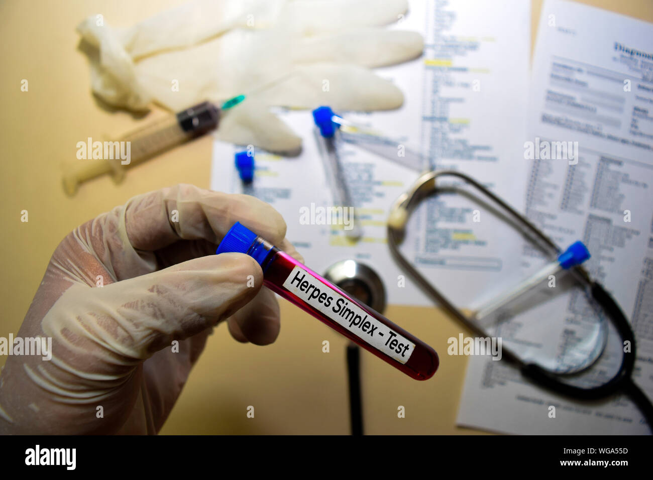 Herpes Simplex - Test with blood sample. Top view isolated on office desk. Healthcare/Medical concept Stock Photo