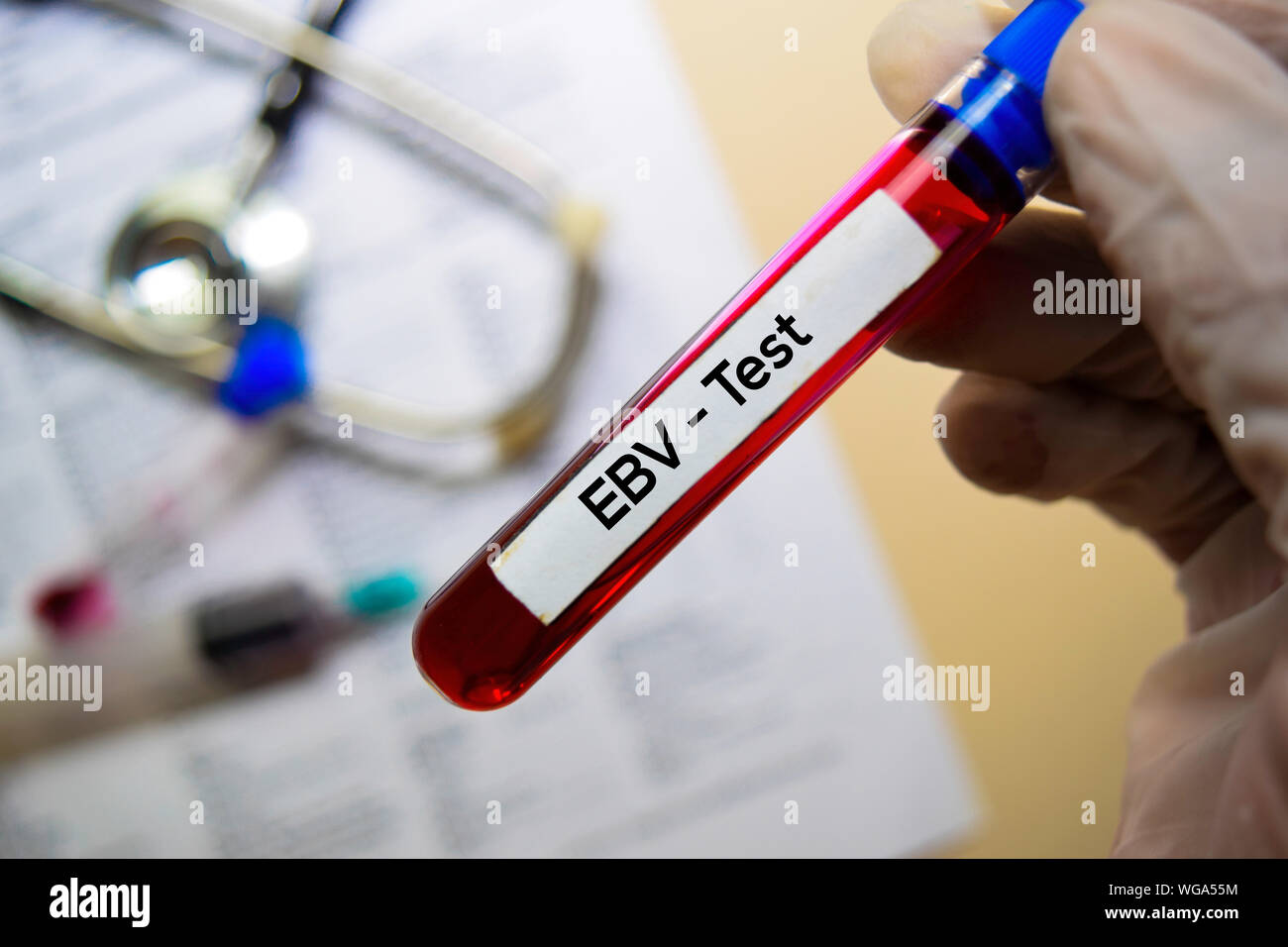 Epstein barr virus hires stock photography and images Alamy