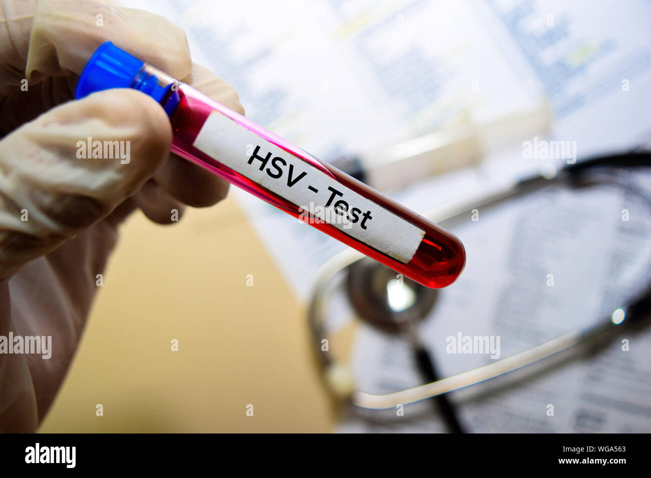 HSV - Test with blood sample. Top view isolated on office desk. Healthcare/Medical concept Stock Photo