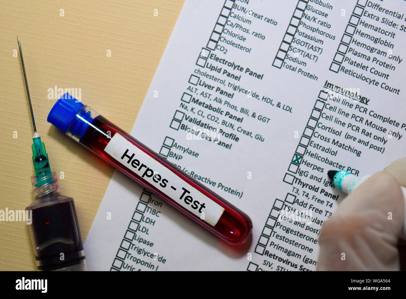Herpes Test with blood sample. Top view isolated on office desk