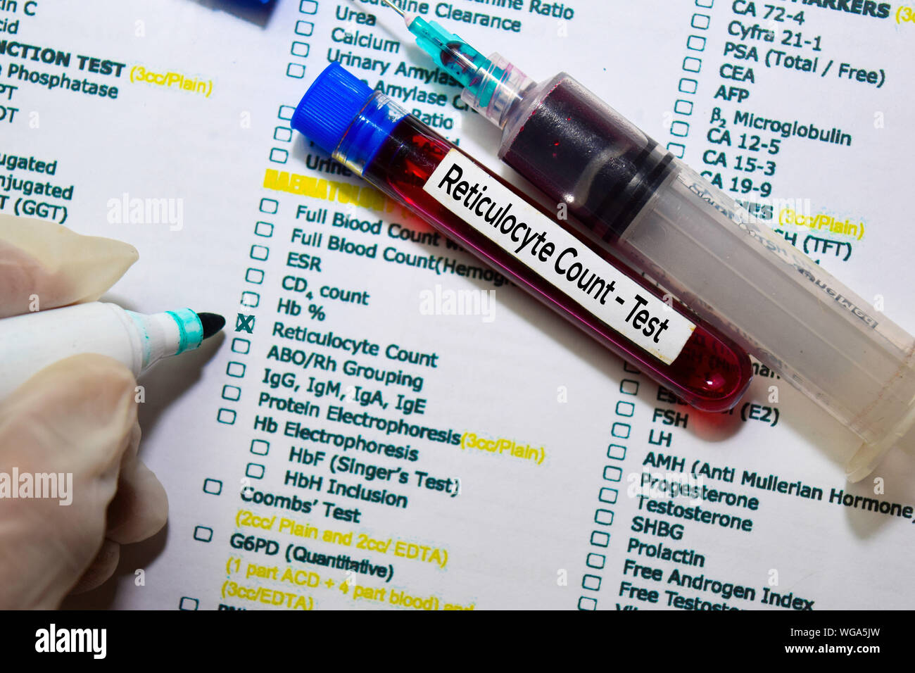 Reticulocyte Count - Test with blood sample. Top view isolated on office desk. Healthcare/Medical concept Stock Photo