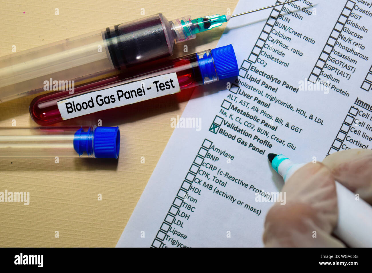 Blood Gas Panel Test with blood sample. Top view isolated on office