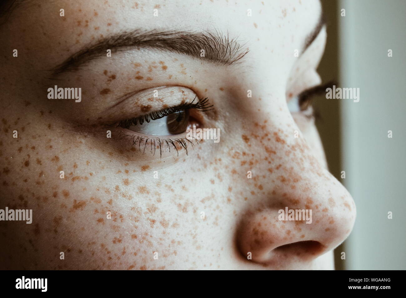 Close-up Of Thoughtful Woman With Freckles On Face Stock Photo