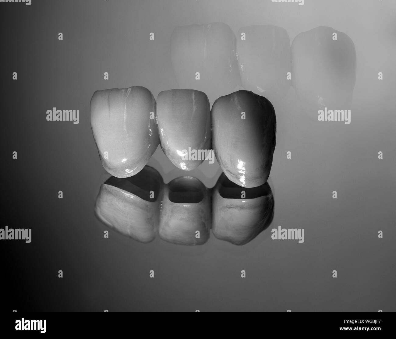 Ceramic crown and bridge Dental technician work Stock Photo Alamy