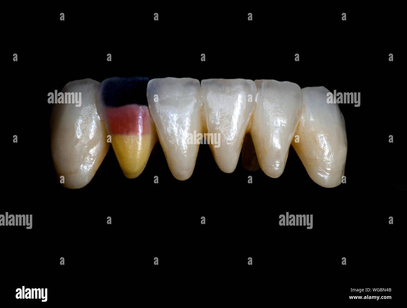 Ceramic crown and bridge Dental technician work Stock Photo Alamy
