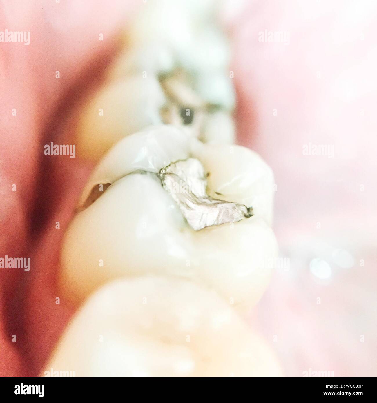 Human teeth row hi-res stock photography and images - Alamy