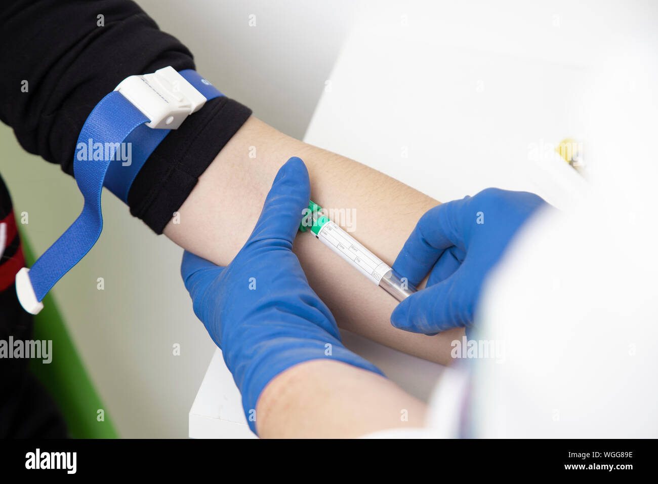 blood sampling from a patient's vein in the laboratory. AIDS and