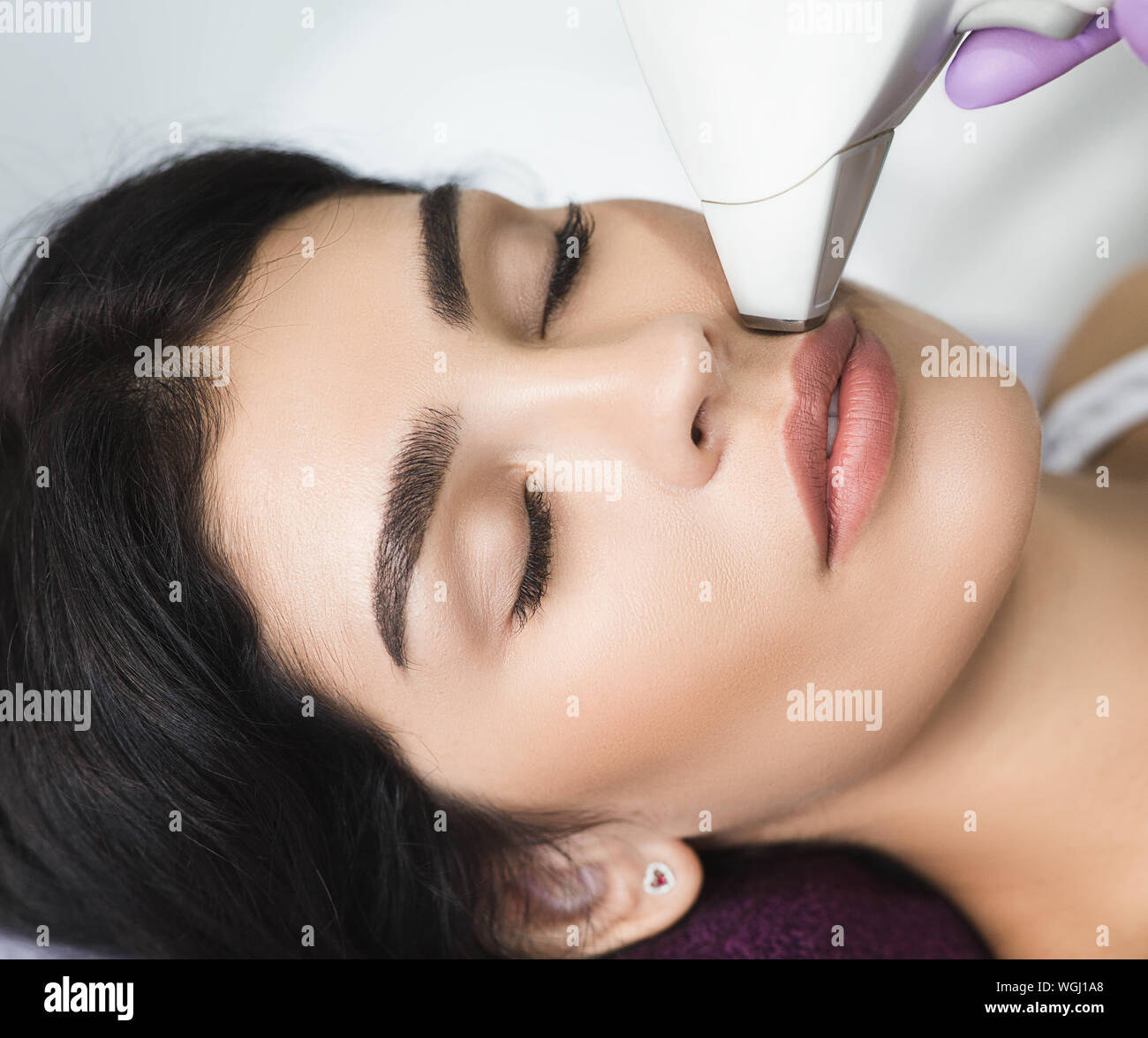 Pretty brunette woman getting hair removing on face. Procedure laser epilation. say no to the female mustache Stock Photo