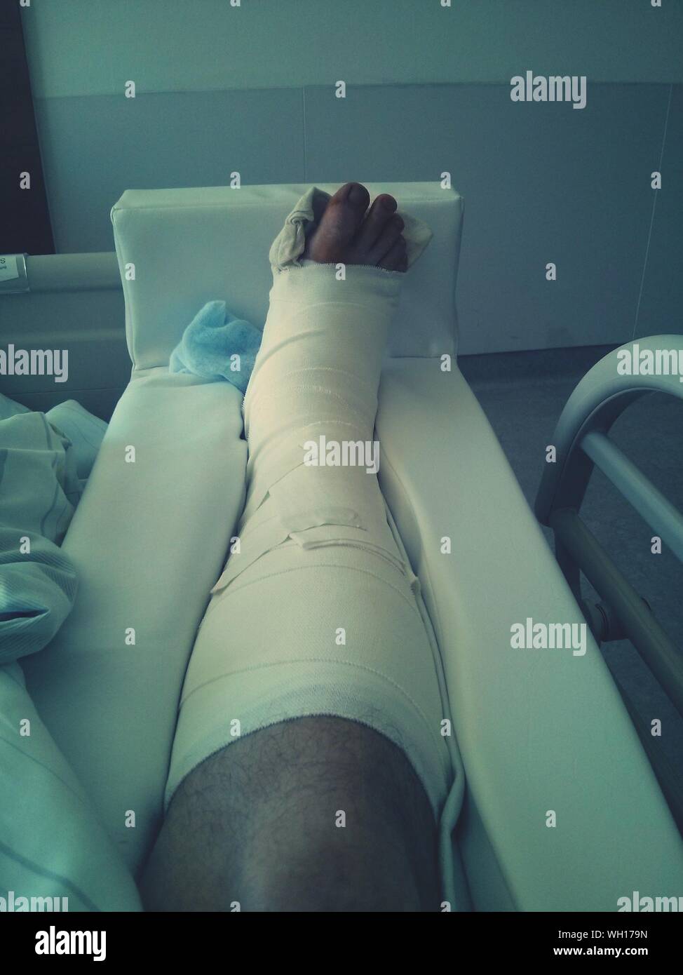 Broken Leg Hospital High Resolution Stock Photography and Images - Alamy