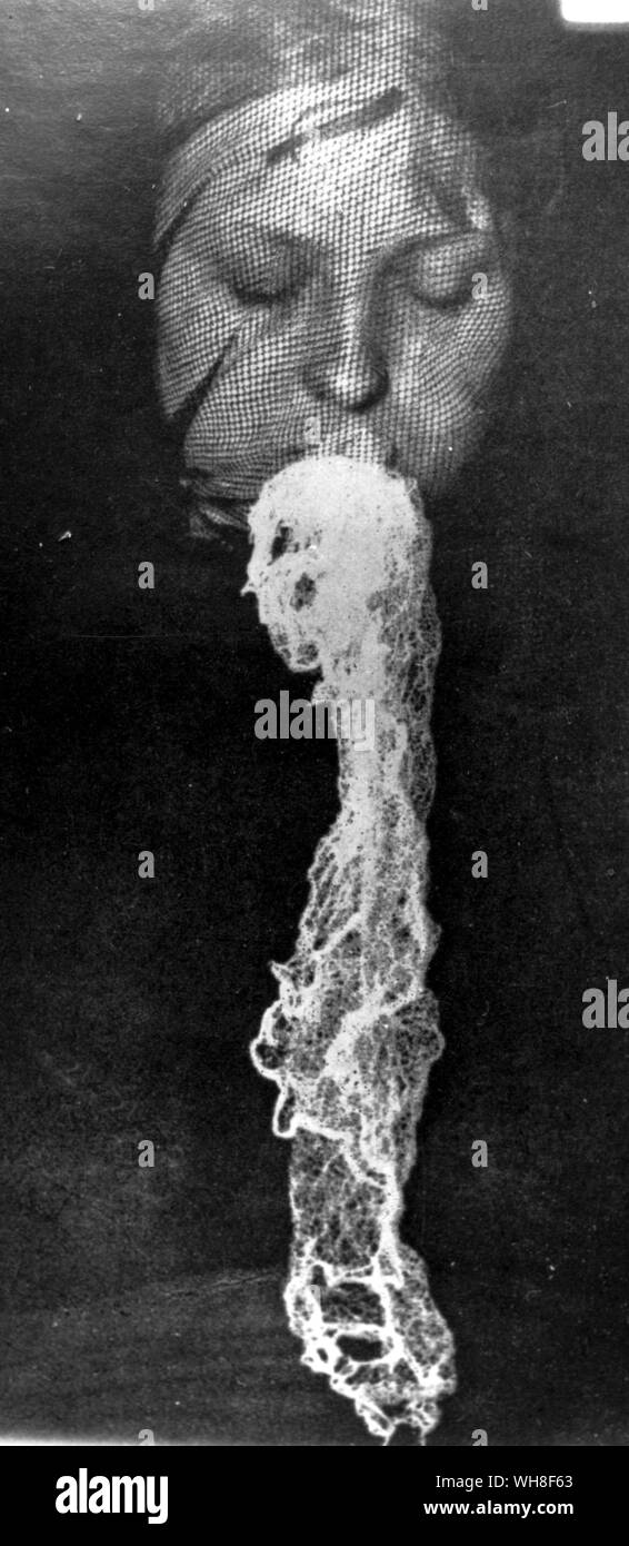 Medium extruding ectoplasm. This is the substance that is claimed to form the material bodies of visiting spirits during a seance. Stock Photo