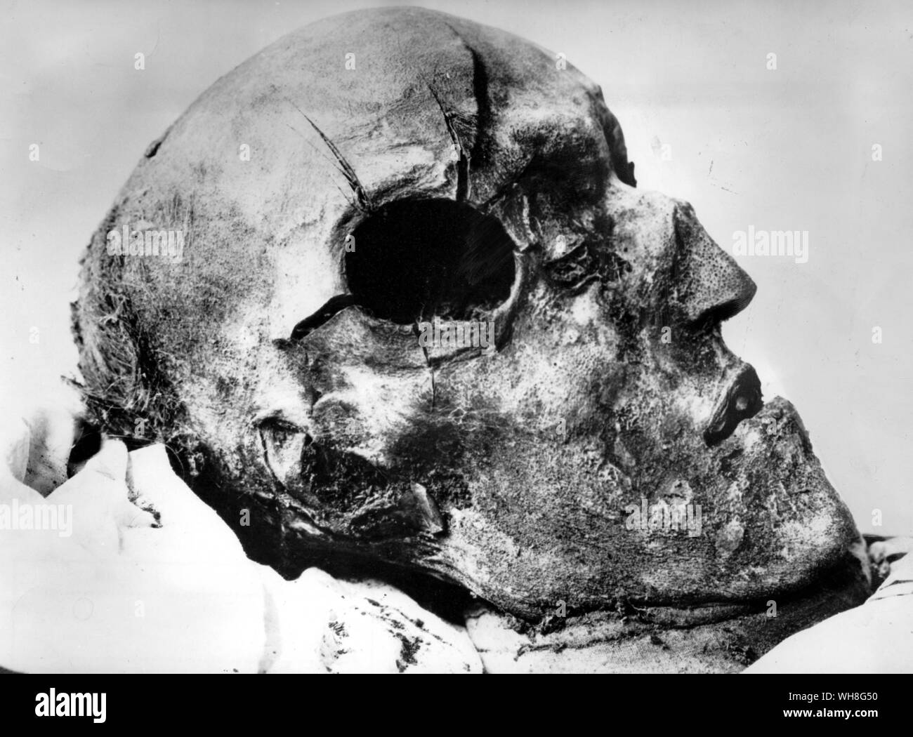 The skull of King Charles XII of Sweden (1682-1718), killed by a cannon shot at the second siege of Fredrikshald in 1718. He was the fourth king of the Wittelsbach dynasty in Sweden. The Romanovs by Virginia Cowles, page 52.. . Stock Photo