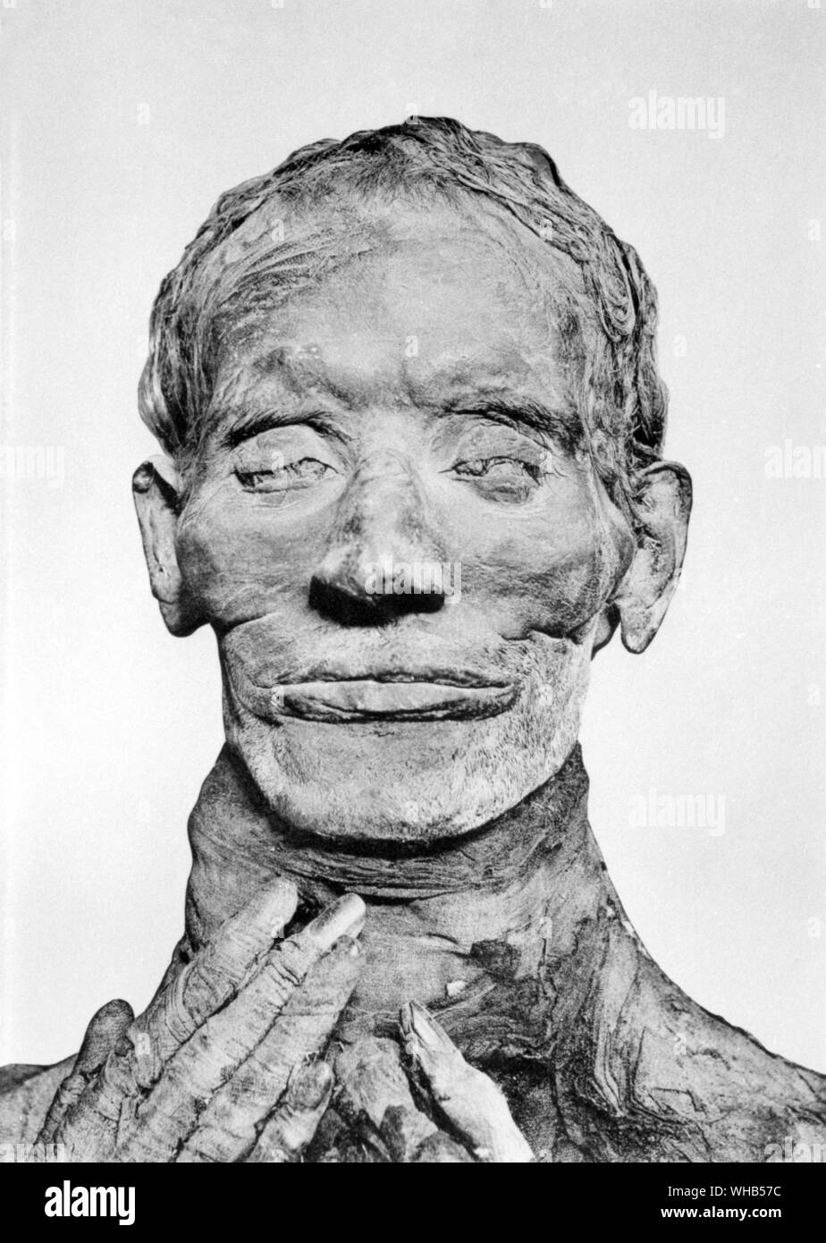 Mummy of yuya juja father-in-law of Amenophius or Amenhotep III. He was a powerful Egyptian courtier of the Eighteenth dynasty of Egypt - ( 1417 - 1379 BC ). . Stock Photo