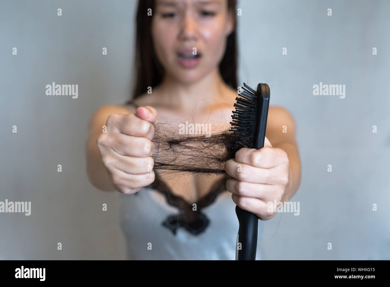 A woman's hair falling out. Hair loss Stock Photo Alamy
