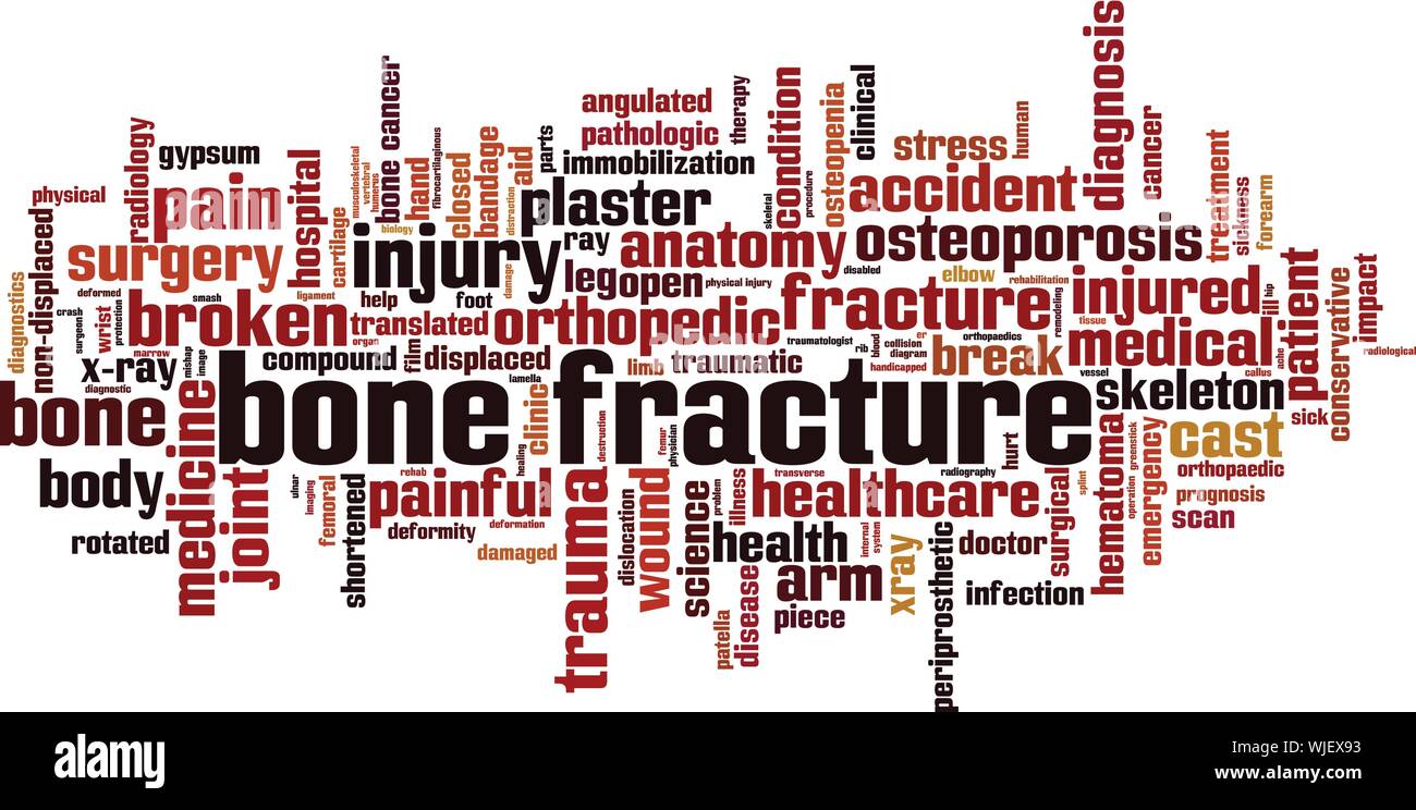Bone fracture word cloud concept. Collage made of words about bone fracture. Vector illustration Stock Vector