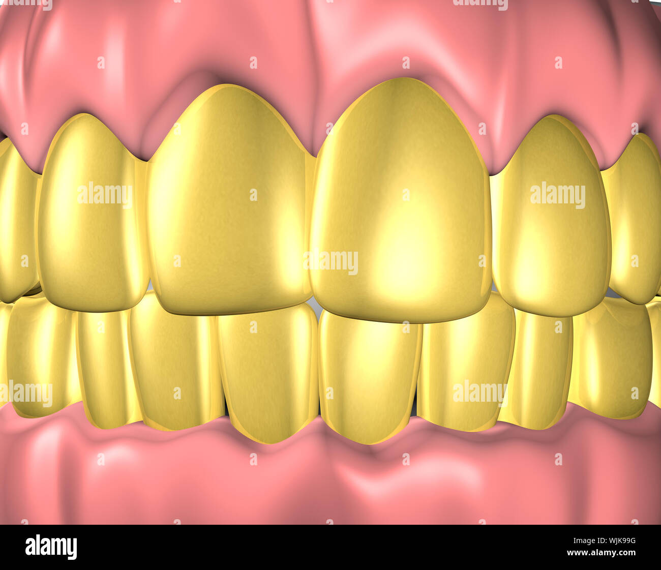 False teeth gold hi-res stock photography and images - Alamy