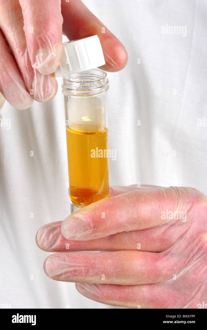 some human urine in a sample bottle Stock Photo Alamy